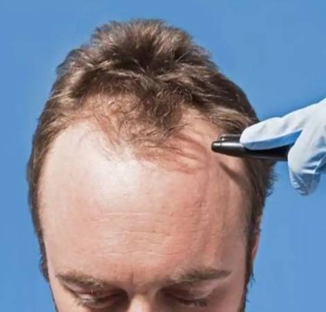Hair Transplant Looks Studio