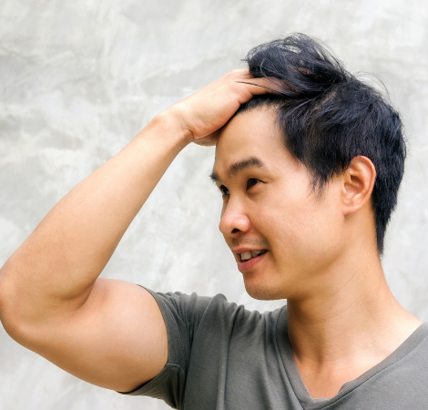 Will i loose my hair after a hair transplant