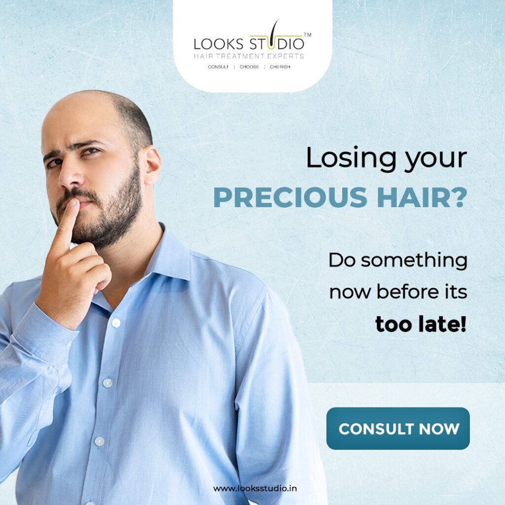 Minoxidil for hair loss