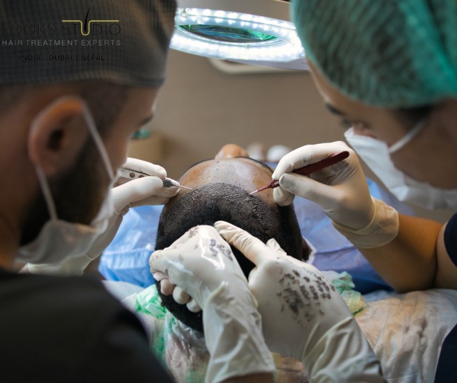 Surgeon’s Experience in Delivering Natural Hair Transplant Results