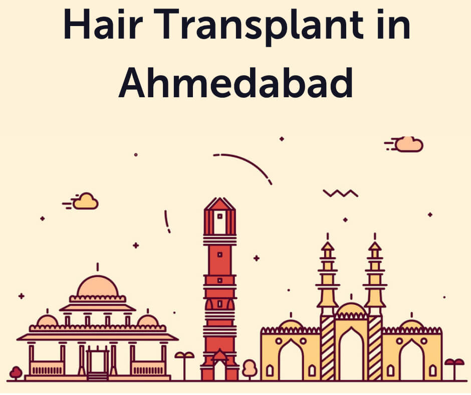 Hair Transplant Ahmedabad