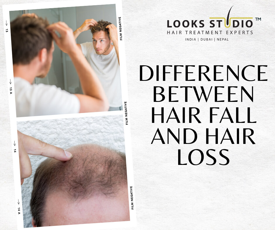 Difference-Between-Hair-Fall-And-Hair-Loss