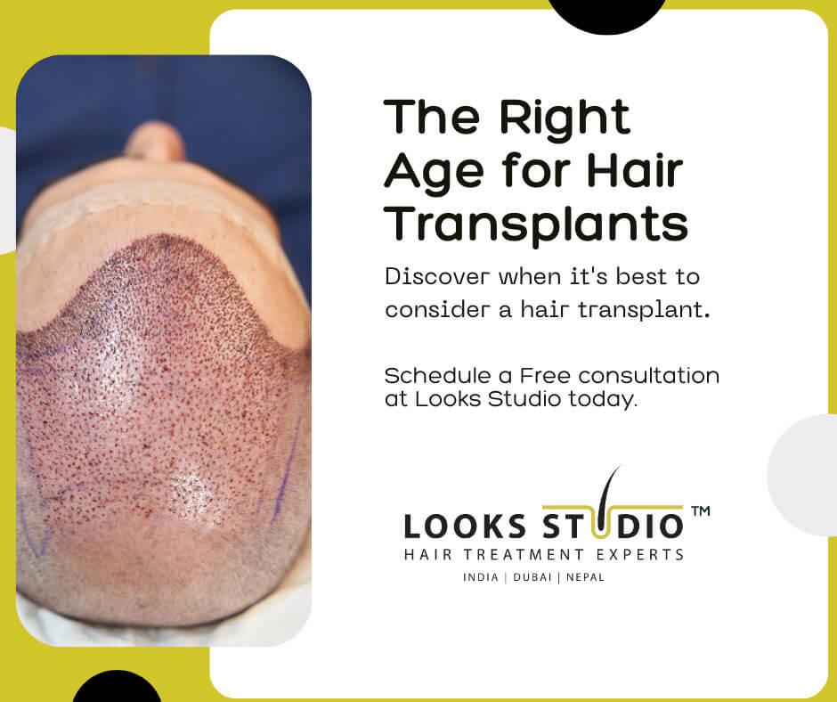 What is the right age to get a hair transplant
