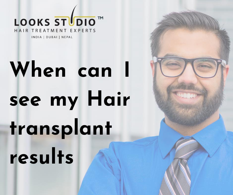 When Can I See My Hair-Transplant Results