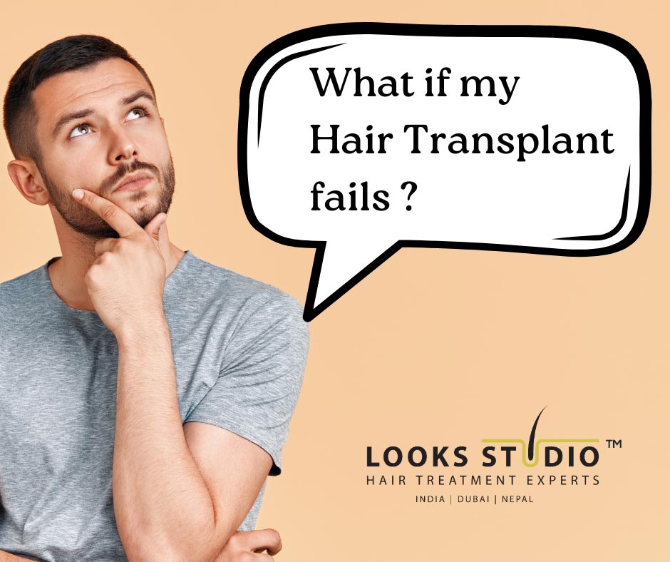 Failed Hair Transplant Steps Options