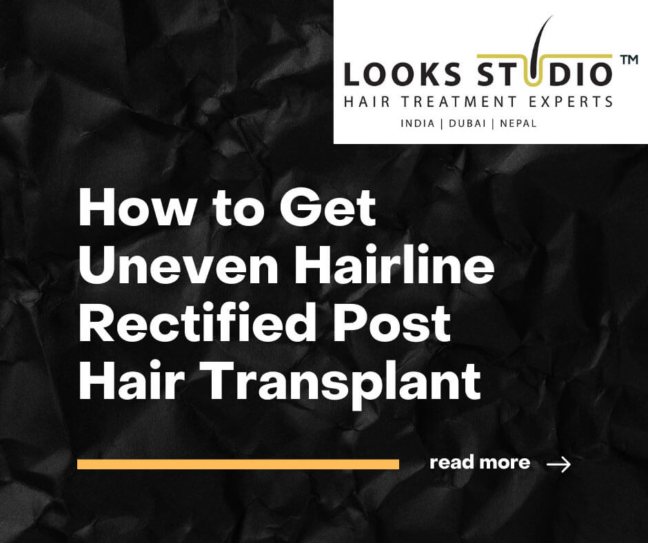 Post Hair Transplant