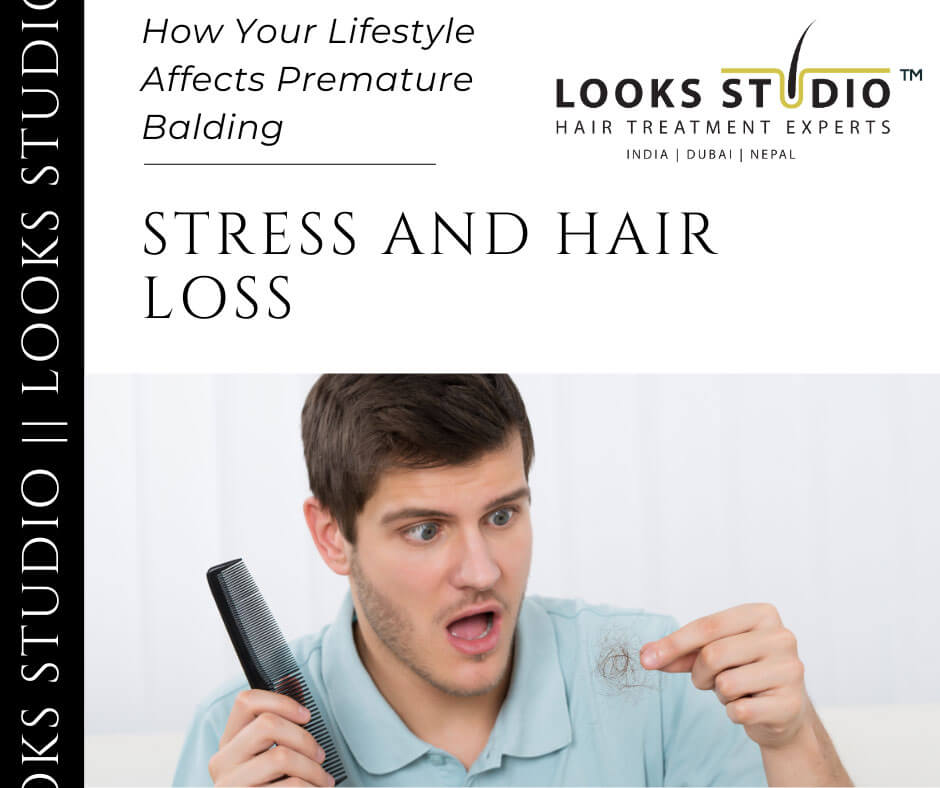 Premature Balding Causes and Treatments