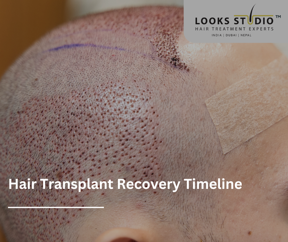 Hair Transplant Recovery