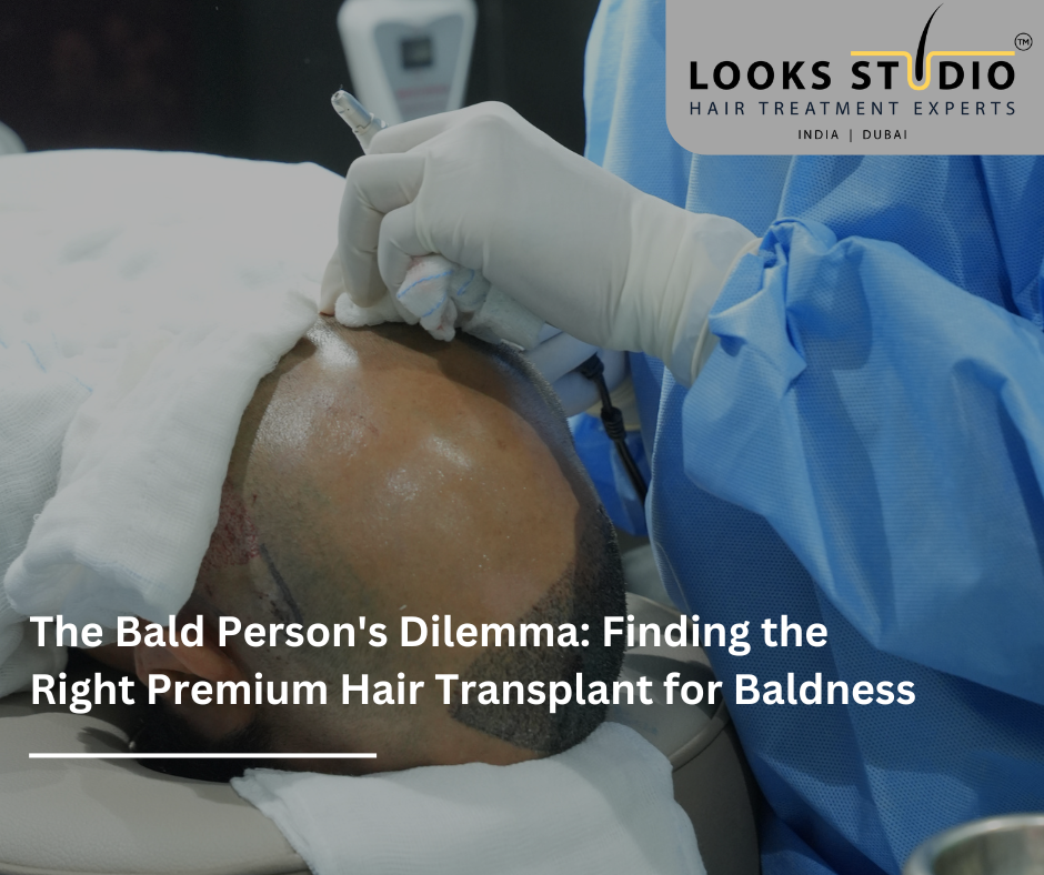 Premium Hair Transplant for Baldness