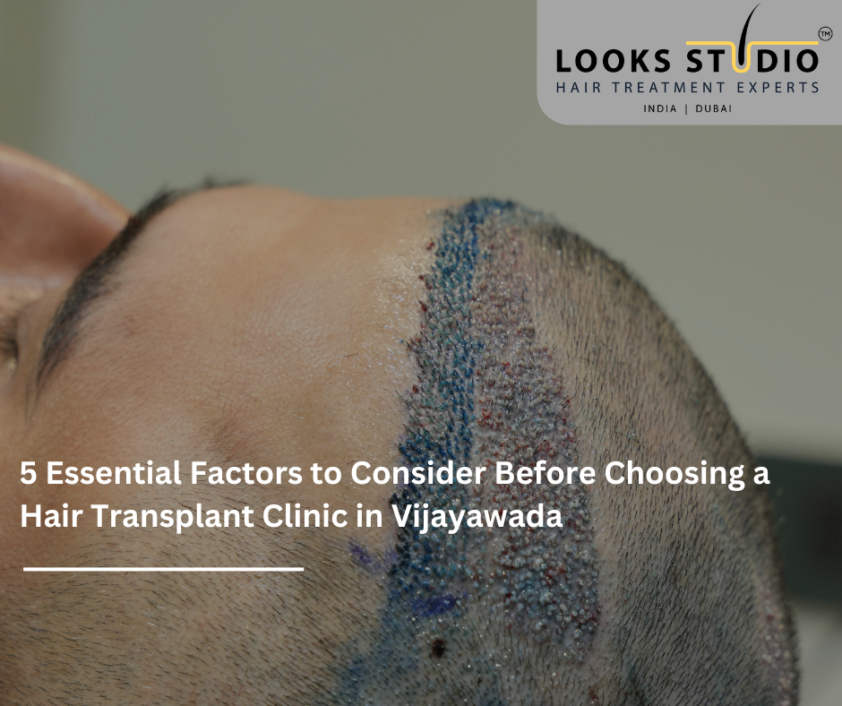 Hair Transplant Clinic in Vijayawada