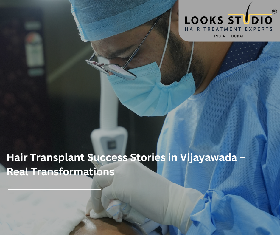 Hair Transplant Success Stories in Vijayawada