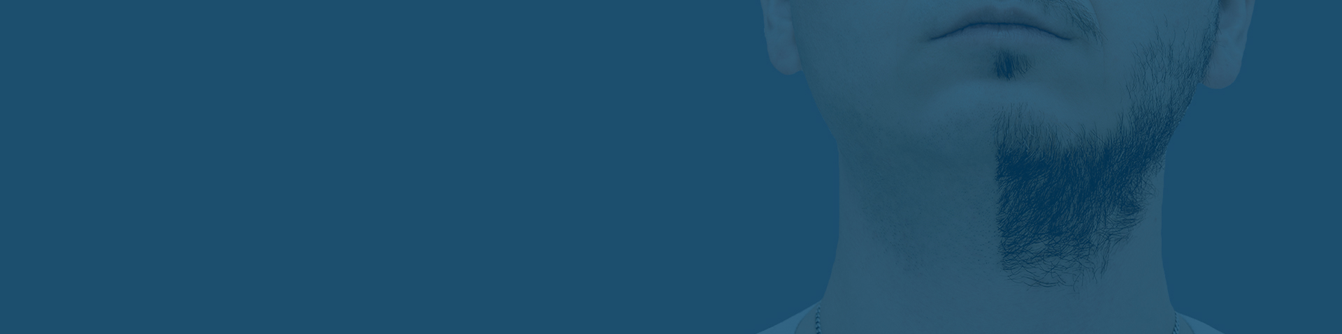 Beard and Moustache Transplant