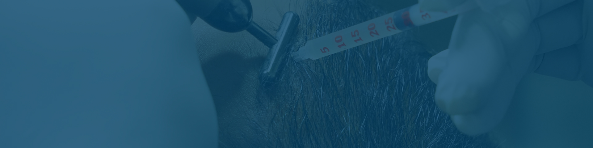 Platelet Rich Plasma (PRP)